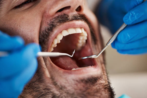 Best Laser Dentistry  in Fairfield, TX